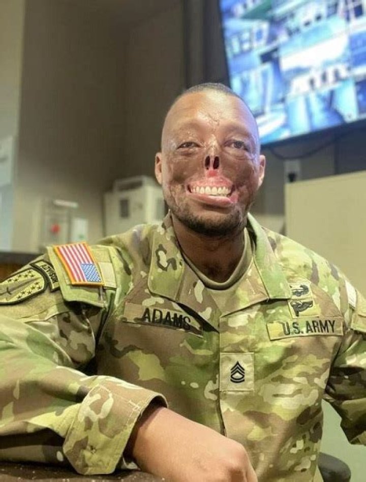 Army: What Happened To Randy Adams? Injury and Burns, Car Accident Update