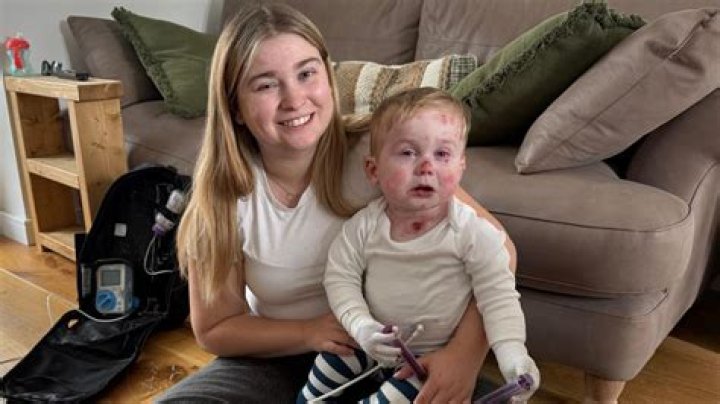 Boxer: What Disease Does Luis Ortiz Daughter Lismercedes Ortiz Have? Her Epidermolysis Bullosa 