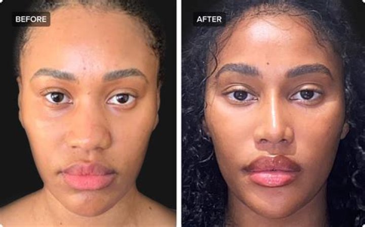 Did Joey King Undergo Nose Job? Plastic Surgery Rumors Debunked