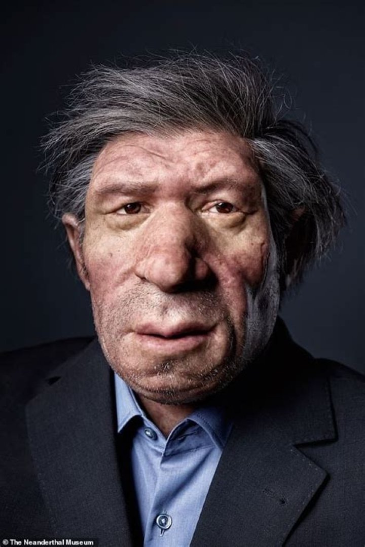 Does Ron Perlman Have Perlman Syndrome? Face Disease: Why Does He Look Like A Neanderthal?