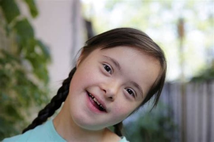 George Clooney's Children With Down Syndrome: A Story Of Love And Acceptance