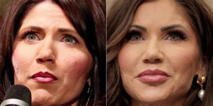 New Details: See Kristi Noem's Plastic Surgery Transformation