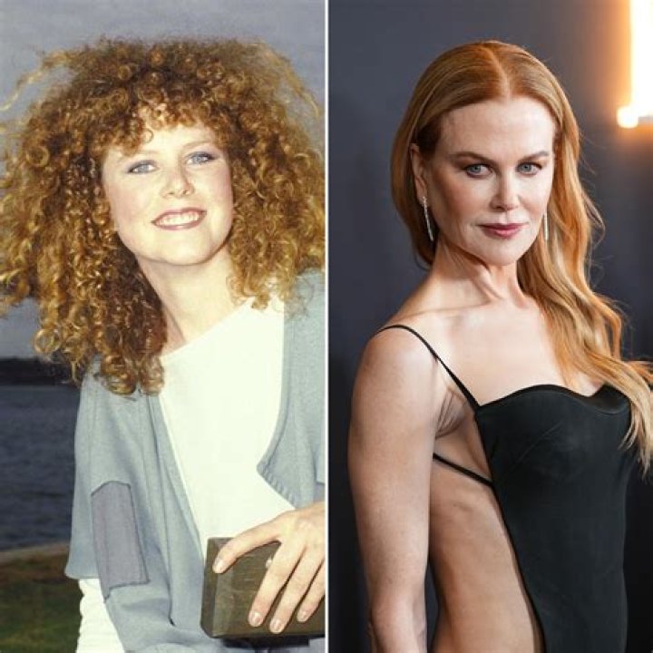 Nicole Kidman: The Journey Of Age And Surgery