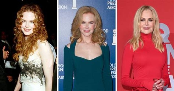 Nicole Kidman: The Transformation Through Facelifts