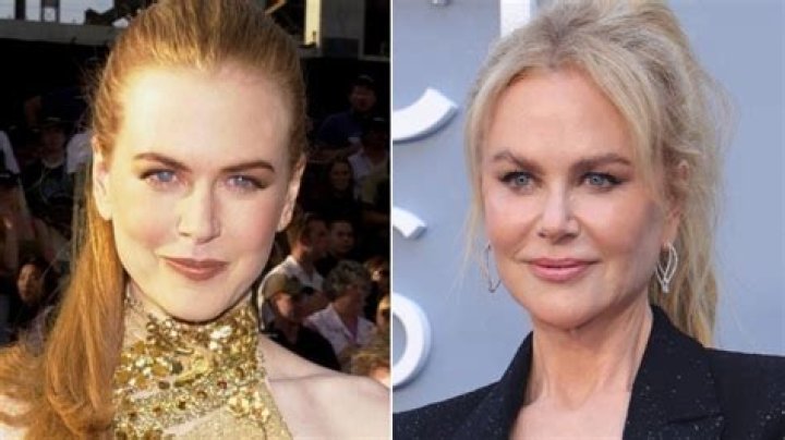 Transformations Of Beauty: Nicole Kidman's Face Changes Over The Years