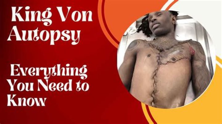 Uncover The Truth: King Von's Autopsy Findings Revealed