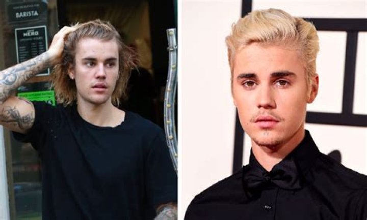 Unraveling The Mystery Of Justin Bieber's Hair Loss