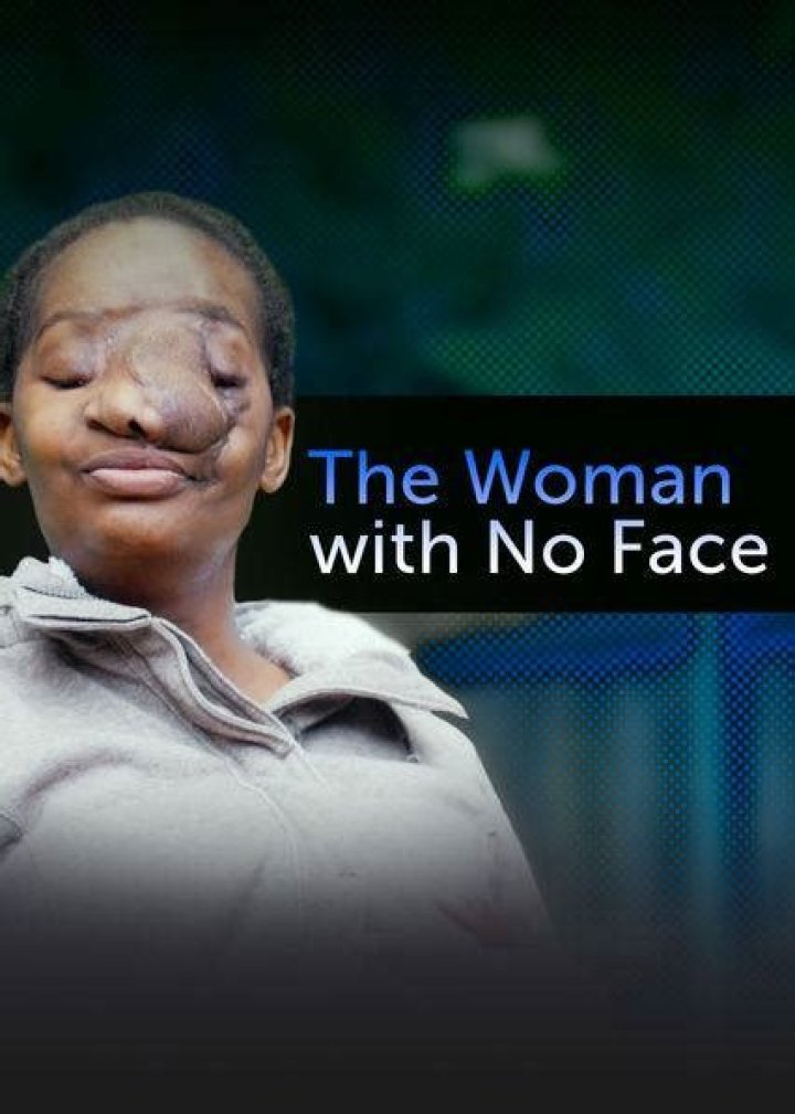 Where Is Tambu Makinzi Now? The Woman With No Face Dead Or Still Alive -Details To Know